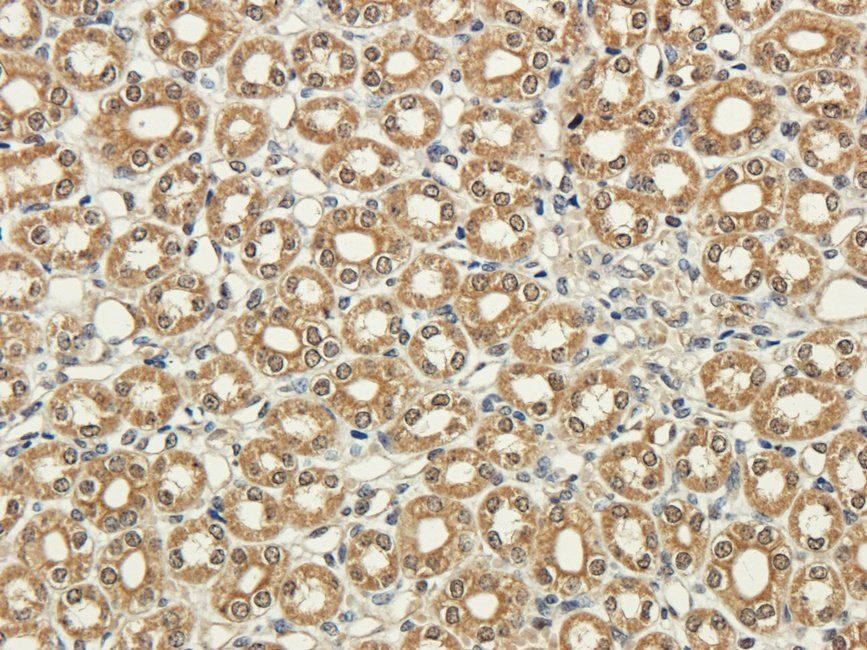 SRBP2 antibody