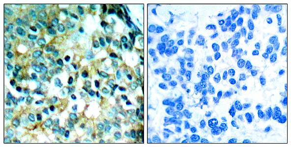 Src(Phospho-Tyr418) Antibody