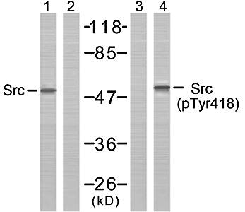 Src(Phospho-Tyr418) Antibody