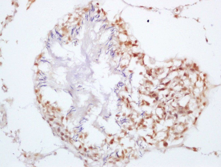 SRD5A2 Rabbit Polyclonal Antibody