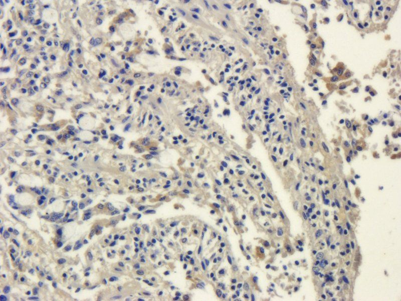 SRD5A2 antibody