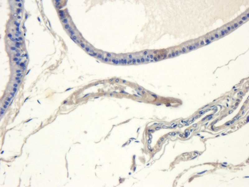 SRD5A2 antibody