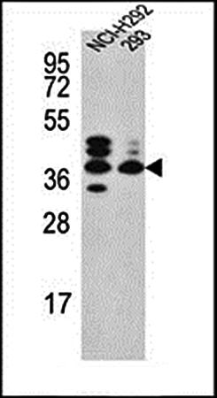 SRD5A3 antibody