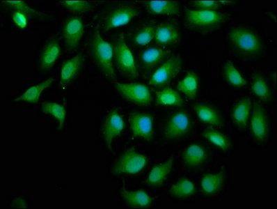 SREBF1 Antibody