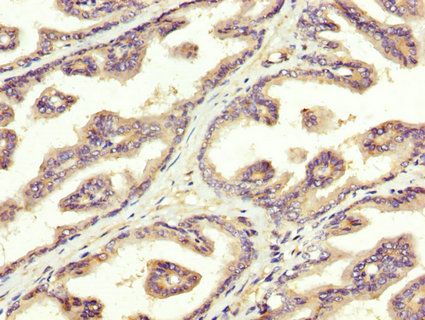 SREBF1 Antibody