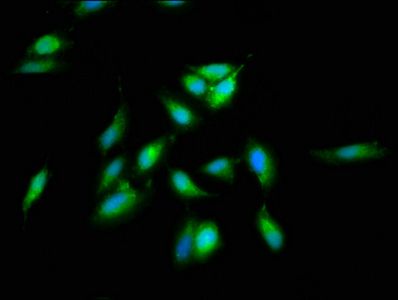 SREBF2 Antibody