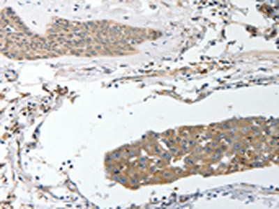 SREBF2 antibody