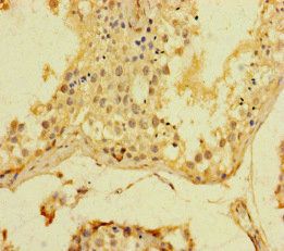 SRF Antibody