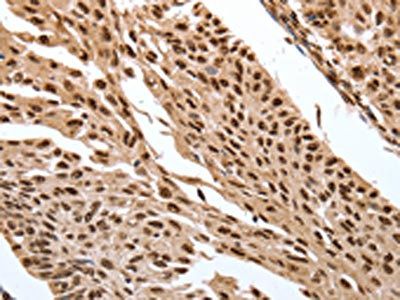 SRF Antibody