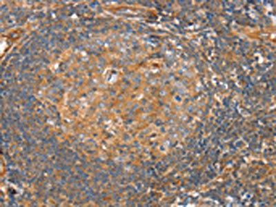 SRGAP3 Antibody