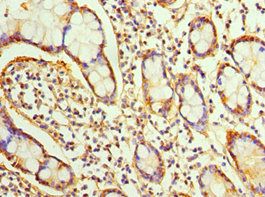 SRI Antibody