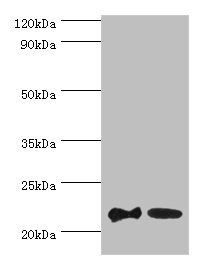 SRI antibody