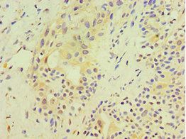 SRM Antibody