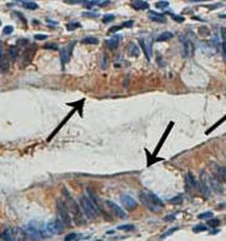 CIDE B Rabbit Polyclonal Antibody