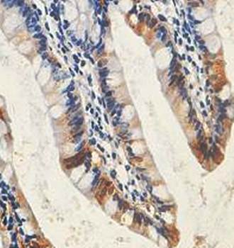 I-FABP Rabbit Polyclonal Antibody