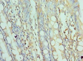 SRPK1 Antibody