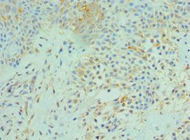 SRPK1 Antibody