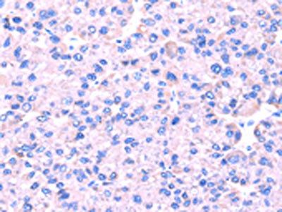 SRPK1 Antibody