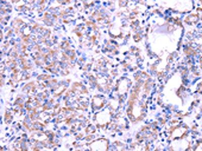 SRPK1 Antibody