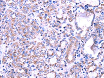 SRPK1 antibody