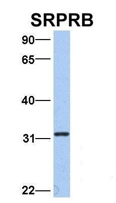 SRPRB antibody