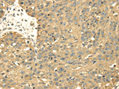SRPRB Antibody