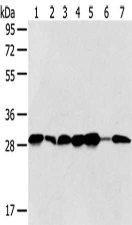 SRPRB antibody