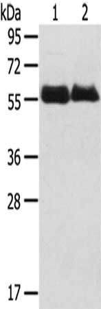 SRPX antibody