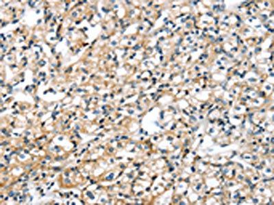 SRPX Antibody