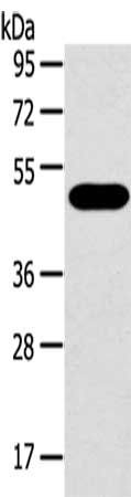 SRPX antibody