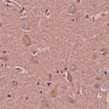 SRPX1 Antibody