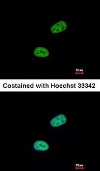 SRPX Rabbit Polyclonal Antibody