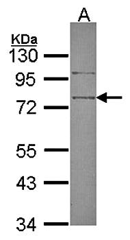 SRPX Rabbit Polyclonal Antibody