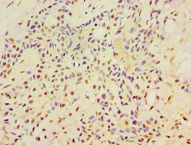 SRRT Antibody
