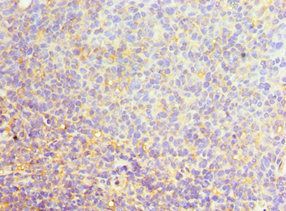SRSF4 Antibody