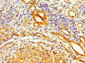 SRSF4 Antibody