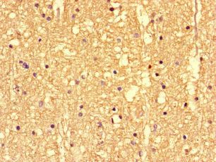 SS18L1 Antibody