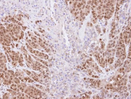 SSA1 antibody [C1C3]