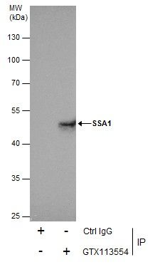 SSA1 antibody [C1C3]
