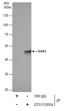 SSA1 antibody