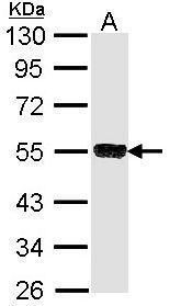 SSA1 antibody