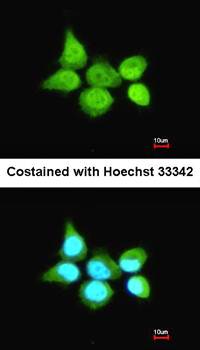 SSA1 antibody