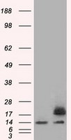 SSB Antibody