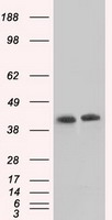 SSB Antibody