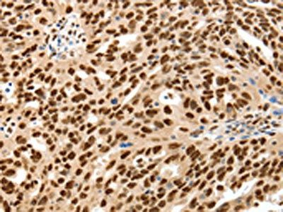 SSB Antibody