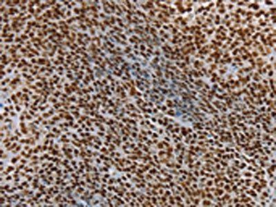 SSB Antibody