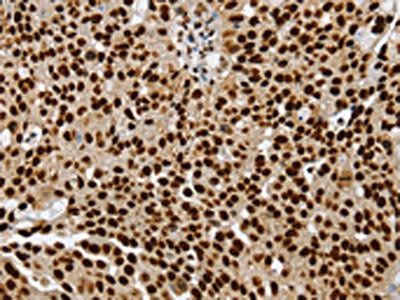 SSB Antibody