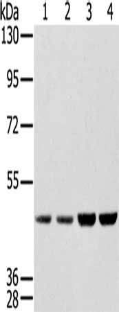 SSB Antibody