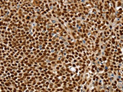 SSB Antibody