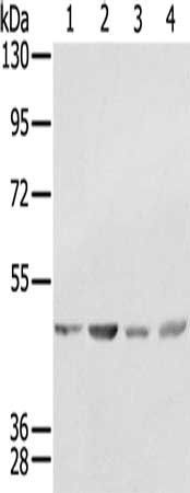 SSB Antibody